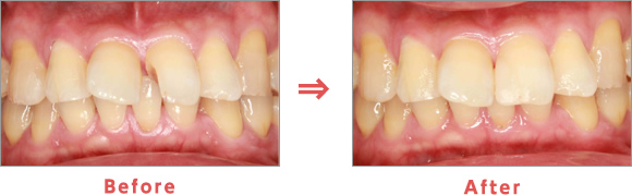症例紹介|枚方の歯科医【本多歯科】
